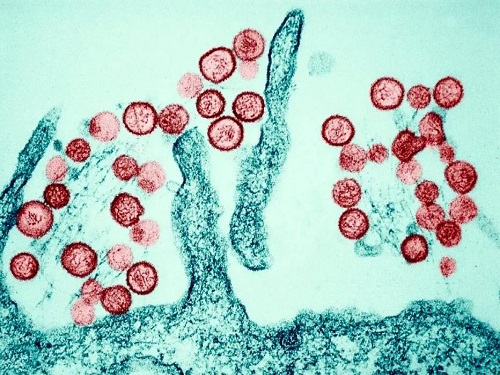 老鼠身上携带的病毒在显微镜下的样子